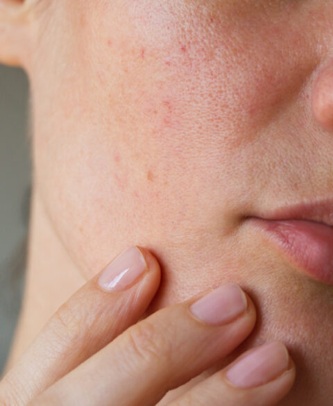 Pourquoi ta peau tiraille après la douche (et comment y remédier)